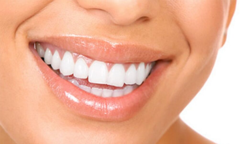 Smile